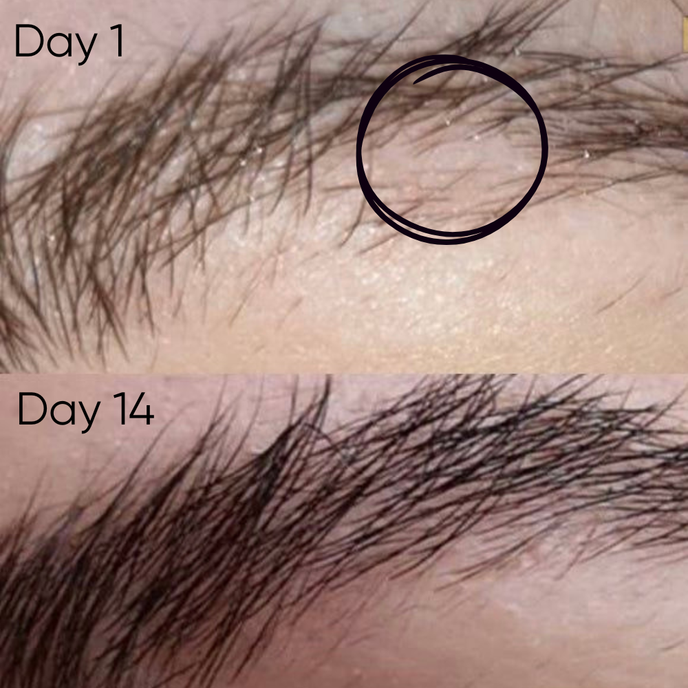 Eyebrow Growth Roller